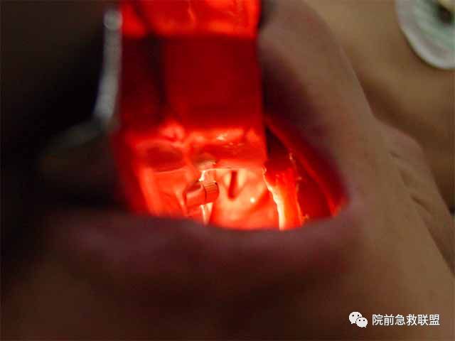 1586482943232269.jpg 微信圖片_20200410094009.jpg